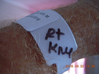Adam's knee X-ray 2
