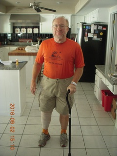 after knee operation + Adam walking away with cane