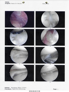 knee surgery images