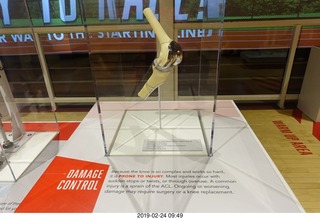 Philadelphia - The Franklin Institute Science Museum - knee exhibit