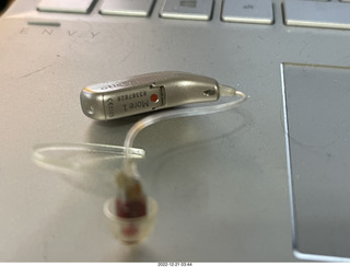 my unbalanced hearing aids on iPhone display