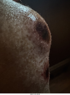 Adam's bloody knee