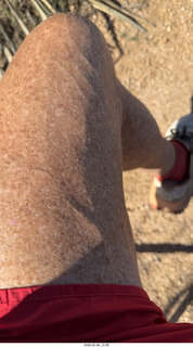 Scottsdale - Granite Mountain Hike - my veined leg